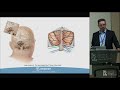 Anatomy of the Dorsal Brainstem, Fourth Ventricle and Telovelar Approach - Zachary N. Litvack, MD