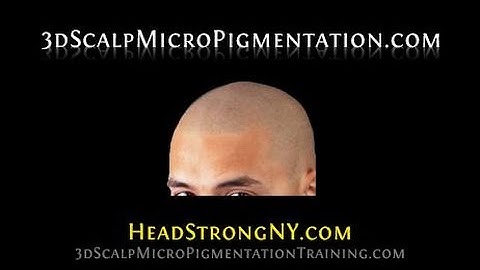 Scalp Micropigmentation Training  The Art with Chris - HeadStrongNY