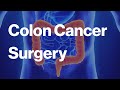 Colon Cancer Surgery