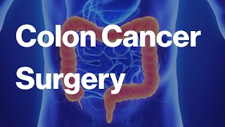 Colon Cancer Surgery