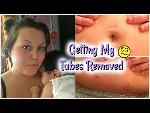 tubal-ligation:-getting-my-tubes-removed-&-after-surgery-|-shannon-jimenez