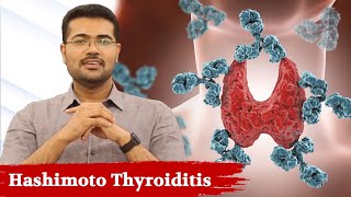 Watch This If You Have Thyroid Problem(Hashimoto Thyroiditis) - Dr. Manoj Johnson