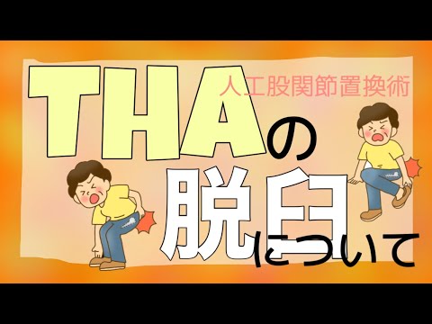 【前編】THA（人工股関節置換術）の脱臼について【整形外科ナース】