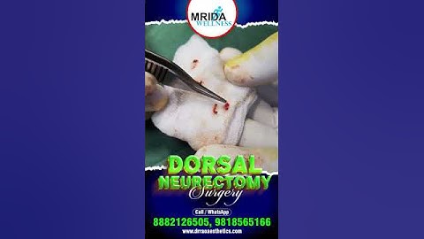 Dorsal Neurectomy Surgery for PME Relief  |  End PME Struggles