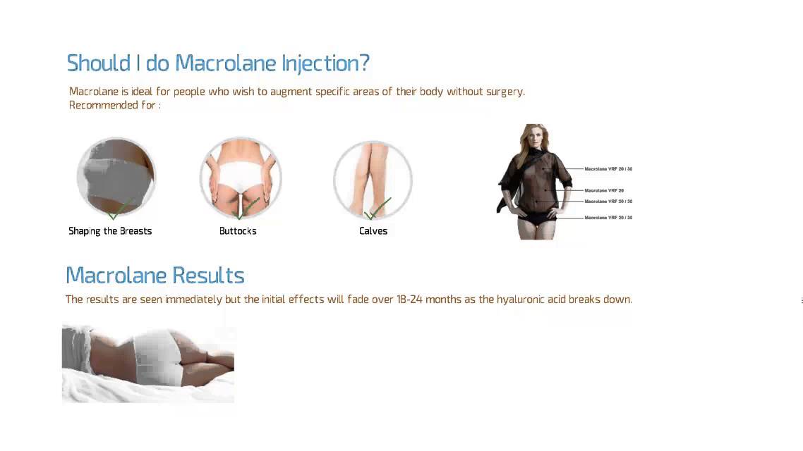Macrolane Injection in Dubai & Abu Dhabi Dubai Cosmetic Surgery YouTube