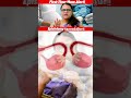 Chocolate cyst Endometrioma இது