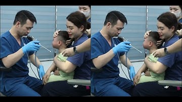 Dị vật hạt lạc trong hốc mũi | Bác Sĩ Hiệu Long Biên