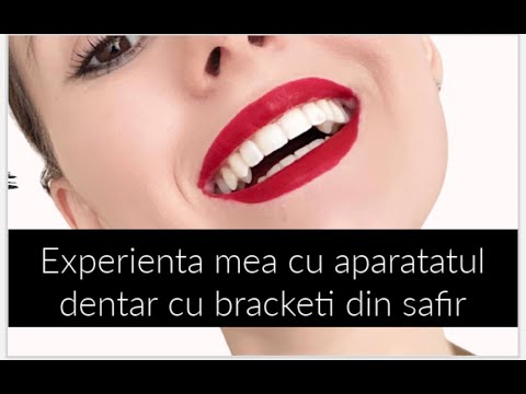 Video: Cum se introduce o nouă tavă Invisalign (cu imagini)