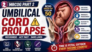 MRCOG Part 2 | Umbilical Cord Prolapse Explained | RCOG Green-top Guideline 50