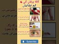 کالا یرقان کی 4 خطرناک نشانیاں جو ہر کسی کو جاننا ضروری ہے 😱#hepatitisc #healthtips #shorts
