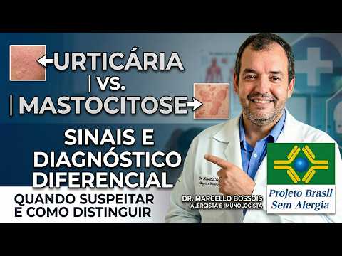 Urticária vs. Mastocitose: Sinais e Diagnóstico Diferencial