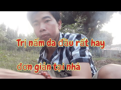 Bài thuốc Trị nấm da đầu (vảy nến,gàu)rất hay.đơn giản tại nhà sử dụng lần 1 đầu là biết kết quả nhé