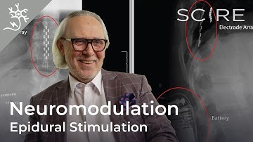 Epidural Stimulation After Spinal Cord Injury: Restoration of Motor and Autonomic Function