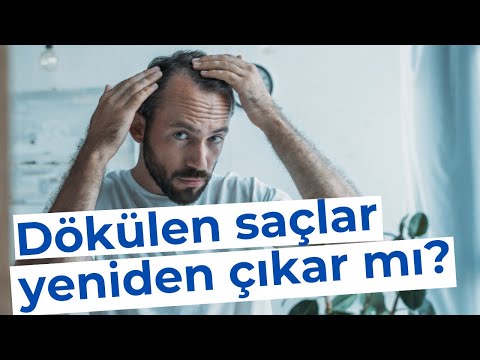 Dökülen Saçlar Yeniden Çıkar mı? - Dr. Hamid AYDIN - YouTube