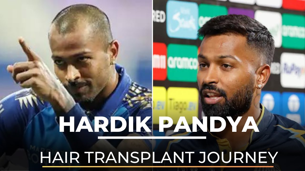 Hardik Pandya Hair Transplant Journey | Dr. Nivedita Dadu - YouTube