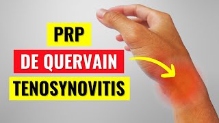 The Truth About PRP Injections for De Quervains Tenosynovitis