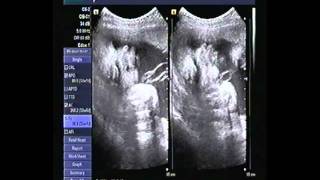 20110219