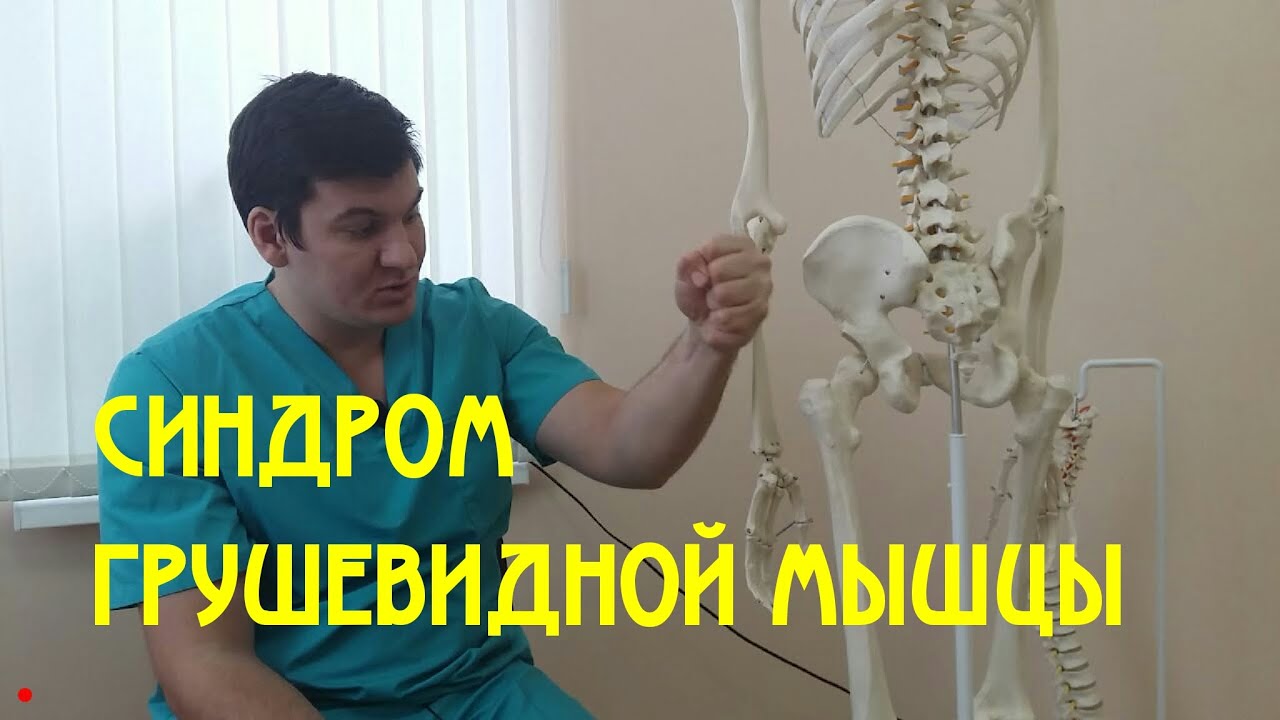 Синдром грушевидной мышцы Piriformis syndrome