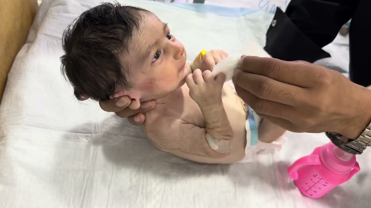 Most Cute Baby in NICU | Feeding Trial Success & Lovely Moment 😊 