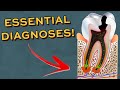 Every Dentistry Diagnoses you NEED to know when seeing patients!