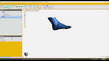 peel 3d™ | Foot Scanning with scan template