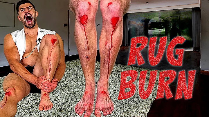 Creating the WORST RUG BURN INJURY of all Time *SC...