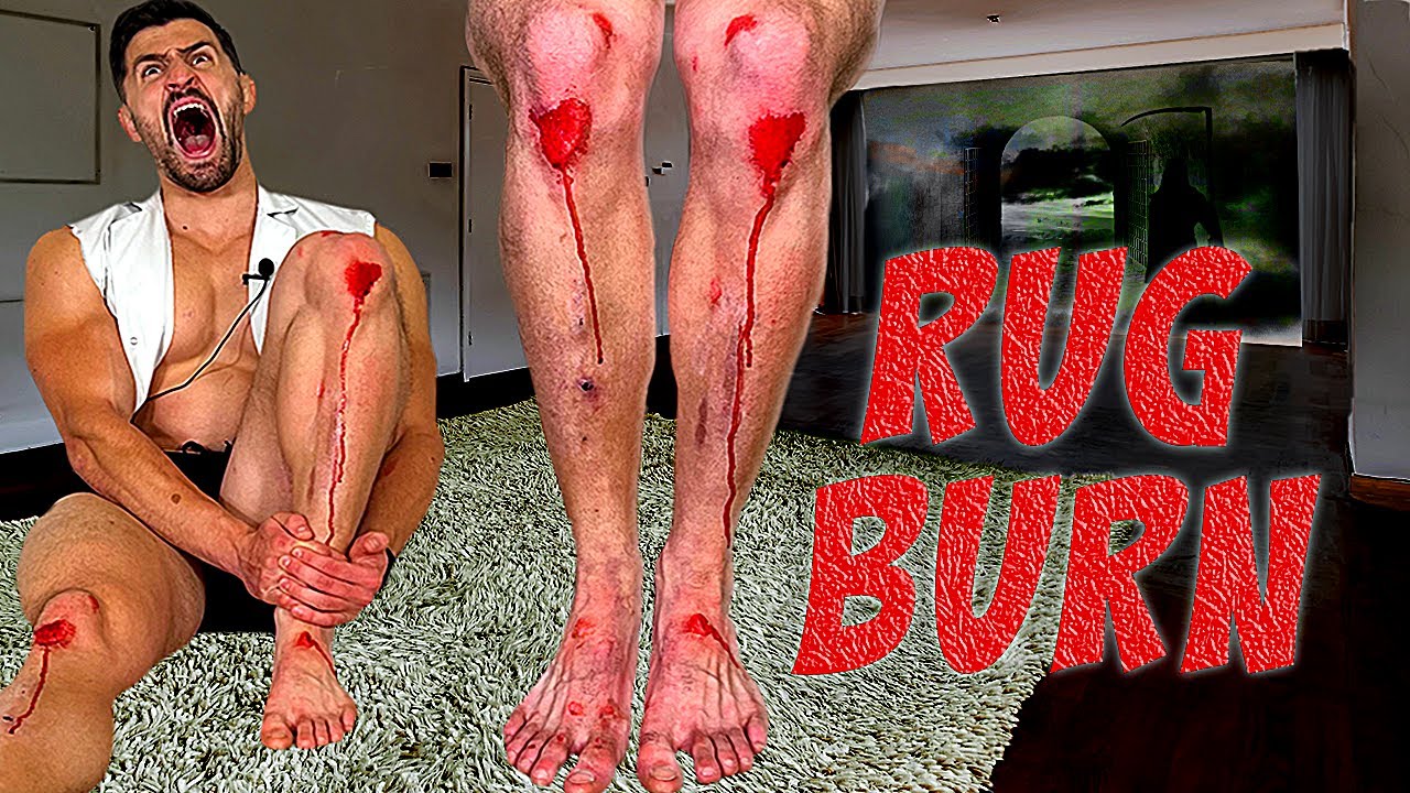 Creating the WORST RUG BURN INJURY of all Time *SCARRED FOR LIFE* 