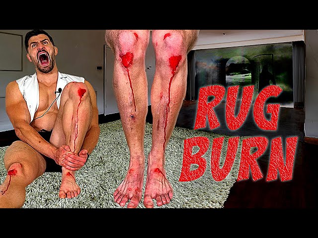 Creating The Worst Rug Burn Injury Of