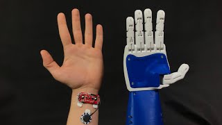 Animatronic 3D Printed Robotic Prosthetic Hand Controlled via EMG