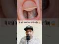 सिर्फ नाखून देखकर पता करें आपके शरीर में कितने बीमारी है! #facts #information #message #shorts
