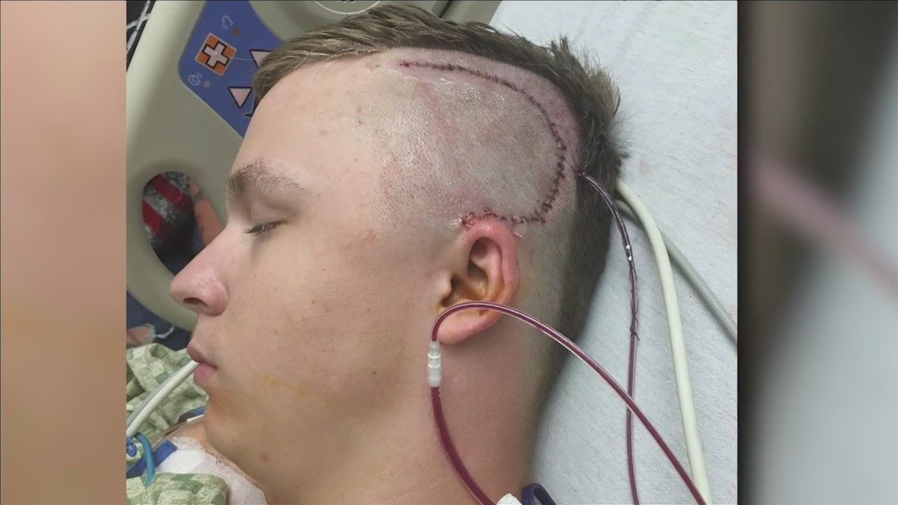 Teenager recovering from brain surgery after freak accident, racks up  $100,000 in bills pkg - YouTube