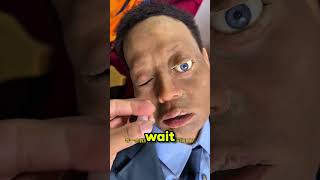 Why are this man's eyes different colors?👀