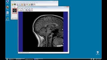 Oblique Sections - Grid Align