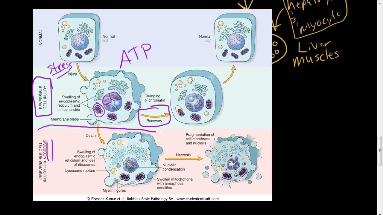 Reversed cell. Cell necrosis. апоптоз кариорексис. morphologic changes in reversible cell injury and necrosis.