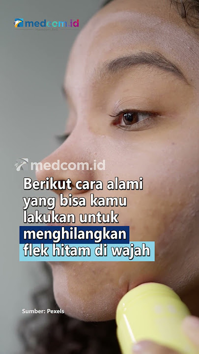 CATAT! CARA HILANGKAN FLEK HITAM DI WAJAH SECARA ALAMI