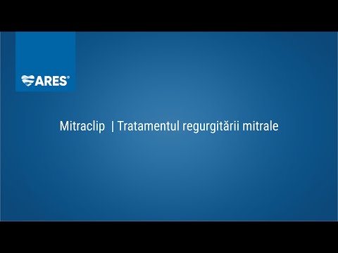 Video: Insuficiența Valvei Mitrale - Tratament, Simptome