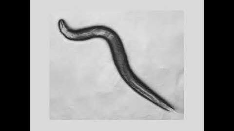 Adult C. elegans tracked on openAutoScope