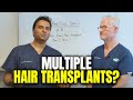 Are You Having A Hair Transplant Surgery? -  How Many Hair Transplants Can You Have?