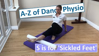 S is for Sickled Feet - A to Z of Dance Physio