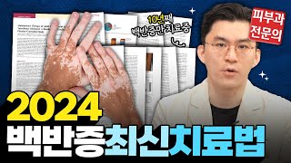 [Eng] All about Vitiligo Treatment: Insights from a Dermatologist