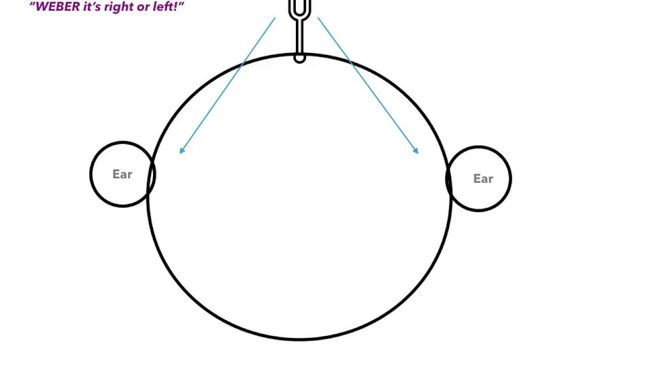 Weber Rinne Chart