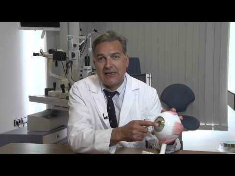 Imagen de Dr. Juan José Pérez Santonja. Trasplante de córnea.
