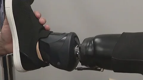 Teacher receives new prosthetics after insurance denials | FOX 7 Austin