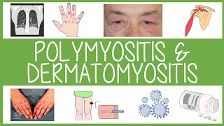 Polymyositis and Dermatomyositis in 3 Minutes