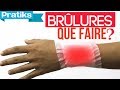 Que faire en cas de brlure premiers secours