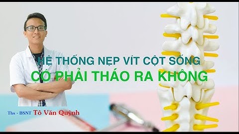 Nẹp vít cột sống, có cần tháo ra không