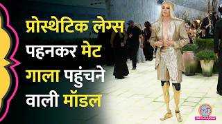 Met Gala 2026 में Golden Prosthetic Legs पहनकर पहुंची Model Lauren Wasser के साथ क्या हुआ था?