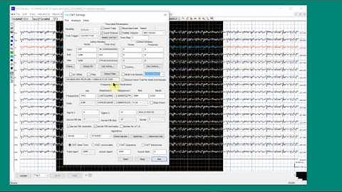 MEG/EEG Time Frequency Analysis 01
