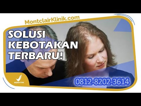 jual-montclair-hair-serum-hilangkan-penyebab-rambut-rontok-pada-wanita-di-bandung-wa-0812-8202-3614