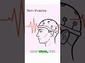 Invasive vs. Non-Invasive Brain-Reading Tech!